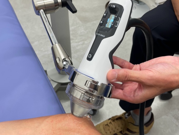 体外衝撃波治療